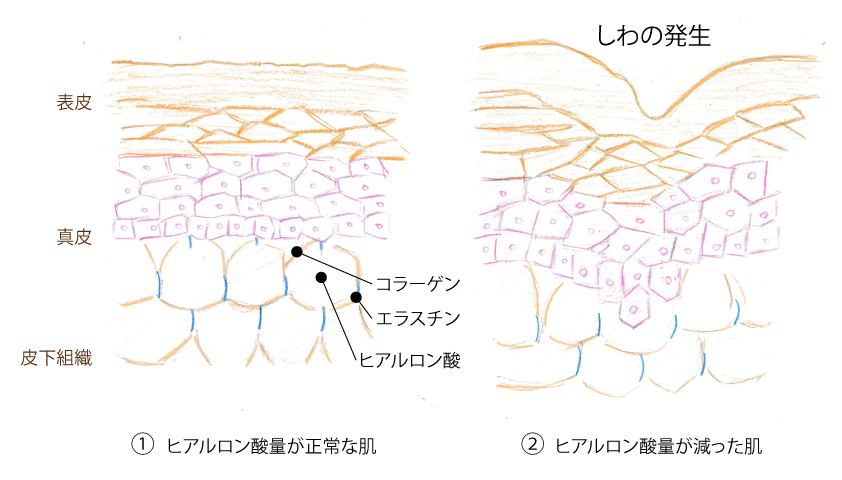 ヒアルロン酸01